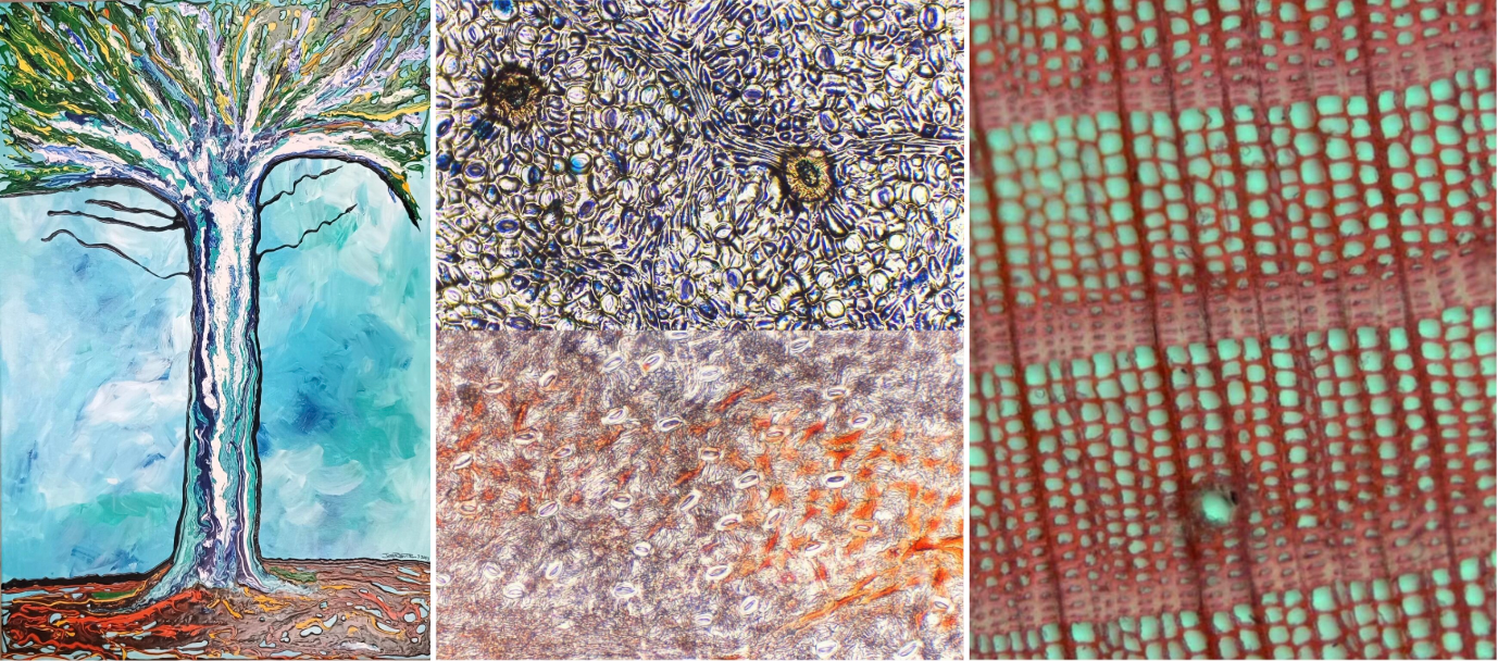 A painting of a tree, a microscope photo of stained plant stomata and another of stained xylem cells that look like a teal and red net