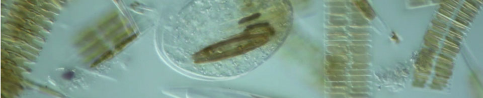 Sea ice algae from ice core