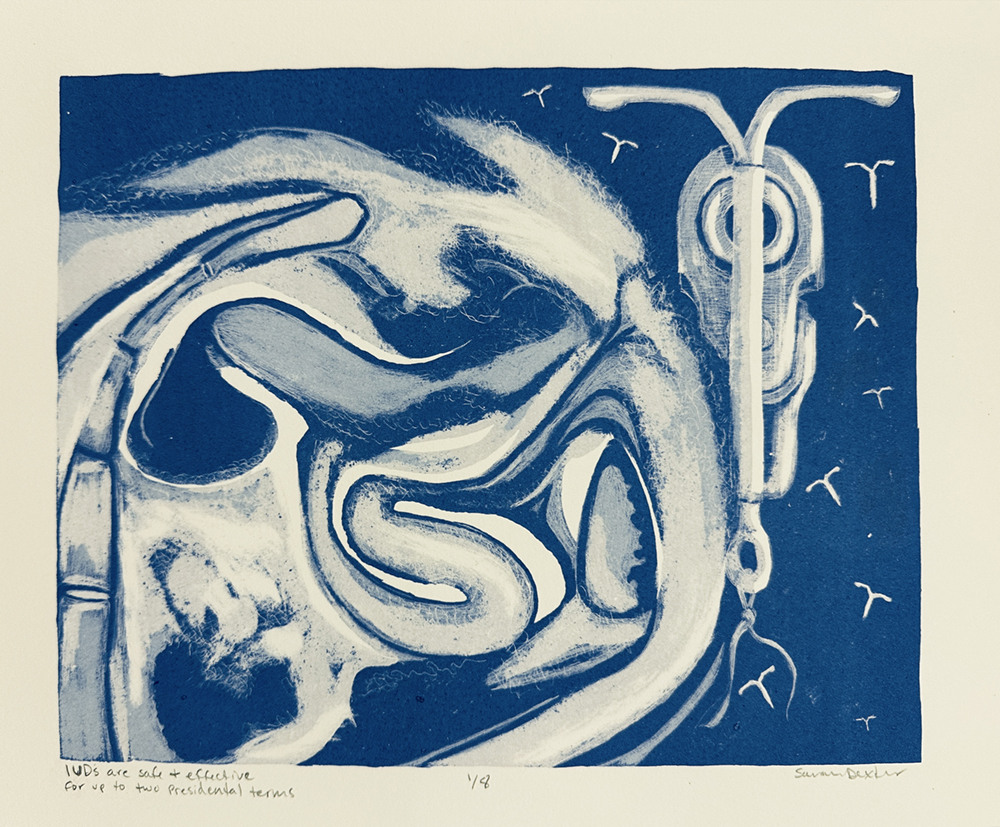 Print of an IUD with blue ink by Sarah Dexter