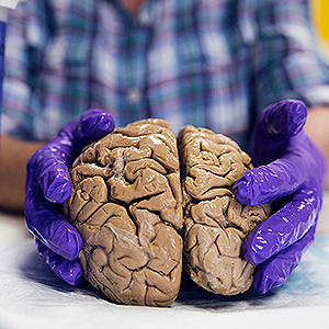 Students purple gloved hands holding a human brain on a counter