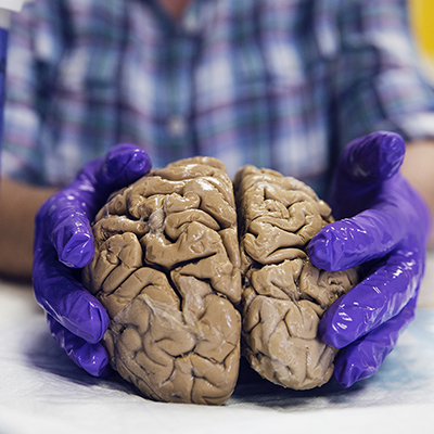Up close image of two hands gently holding a specimen of a human brain in front of the jar it is kept in