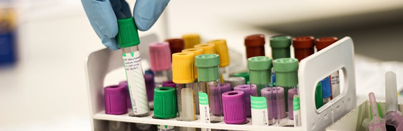 hand with medical vials