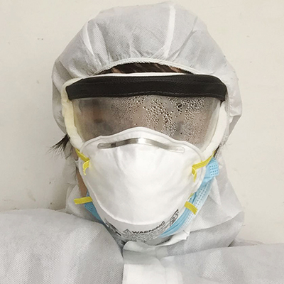 Qian Li's goggles become foggy while working. Photo courtesy by Qian Li.