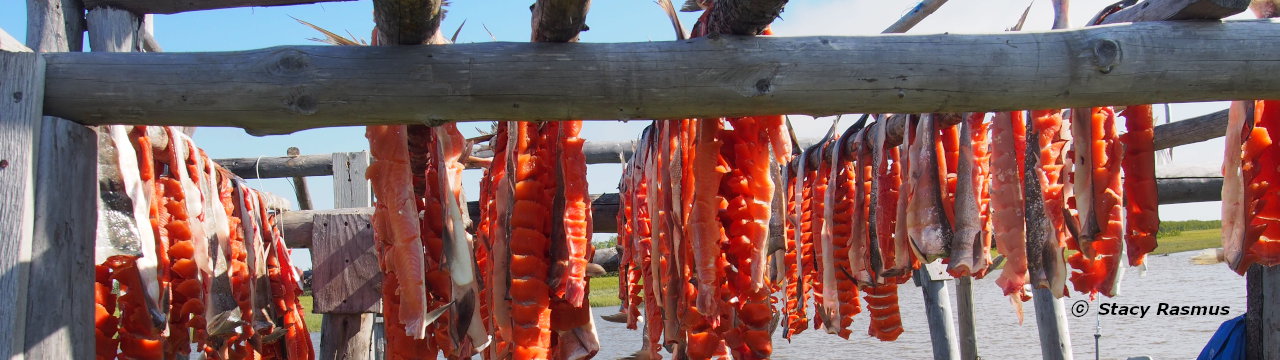 Center for Alaska Native Health Research