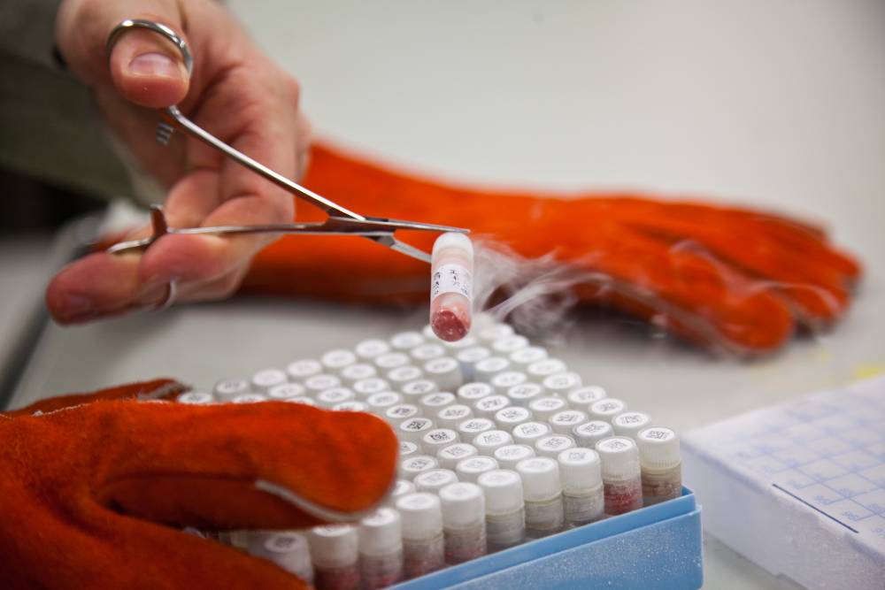 A tissue vial being removed from a box of frozen tissues