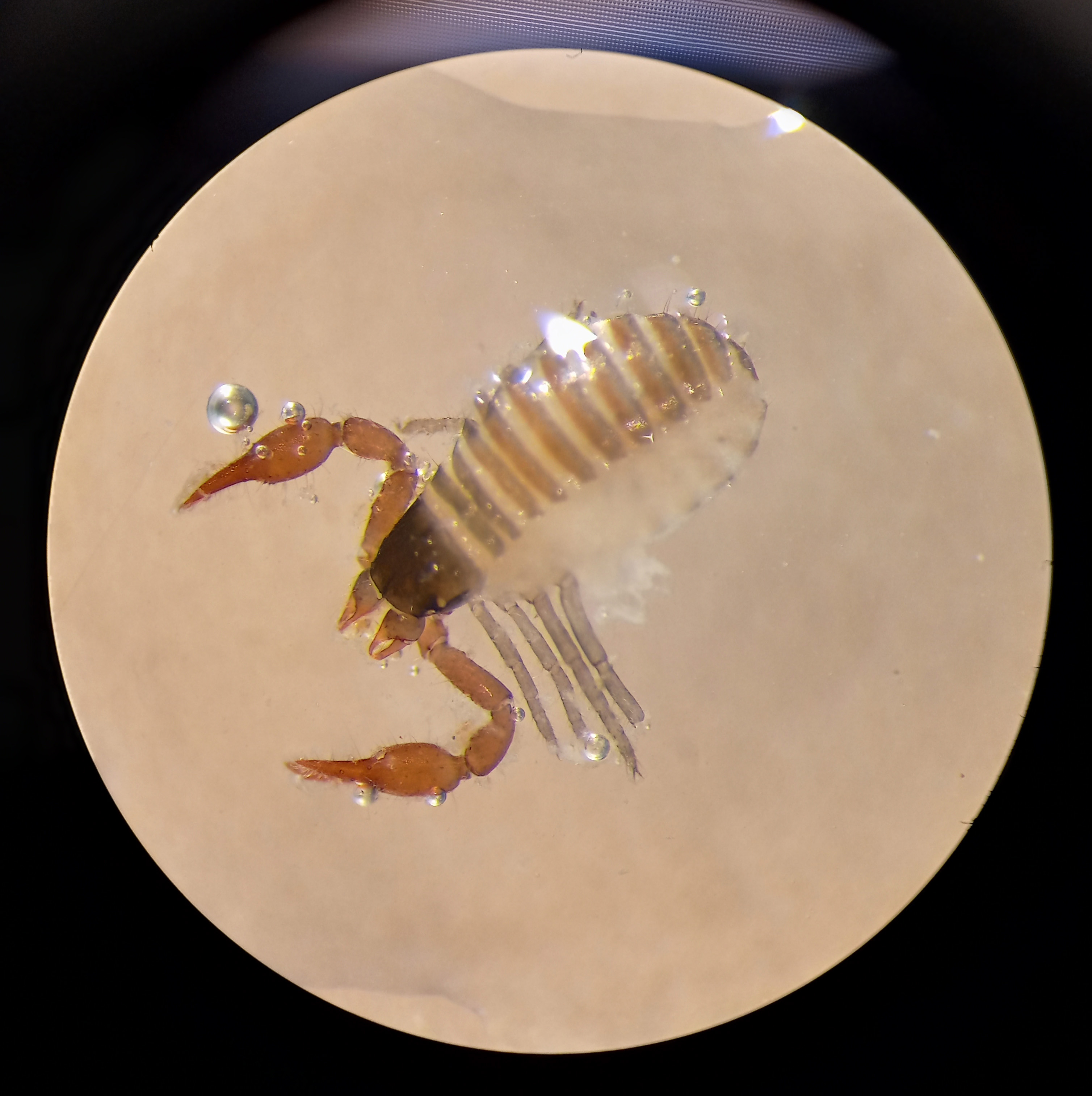 A pseudoscorpion was among the samples of invertebrates found at Kenai Peninsula sites.
