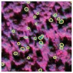 Dead spruce in 2021 satellite image - showing manually delineated dead spruce